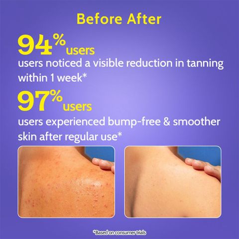 Chemist At Play 4% Exfoliating Body Wash with Lactic Acid &amp; Salicylic Acid - product image 6