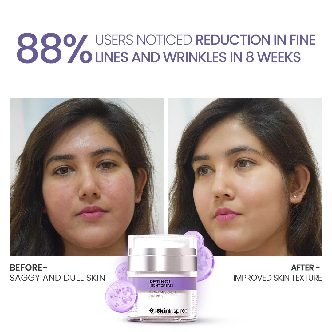 Retinol Renewal Night Cream
