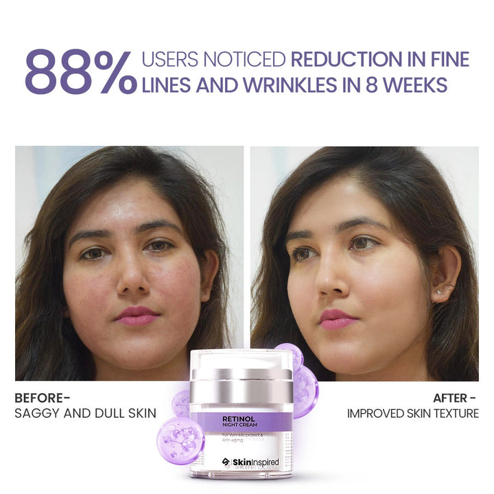 Retinol Renewal Night Cream