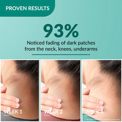 Fixderma Nigrifix Cream for Dark Body Patches - product image 5